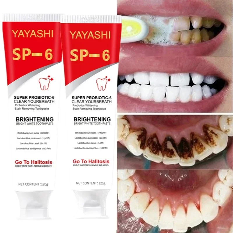 Probiotic Toothpaste SP-6 Whitening Tooth Remove Plaque Stains Teeth Whitener Or