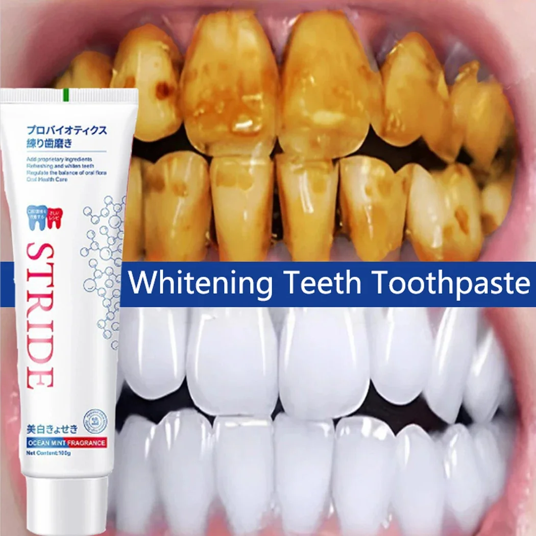 Dental Calculus Remover Removal Bad Breath Whitening Teeth Toothpaste Brightenin