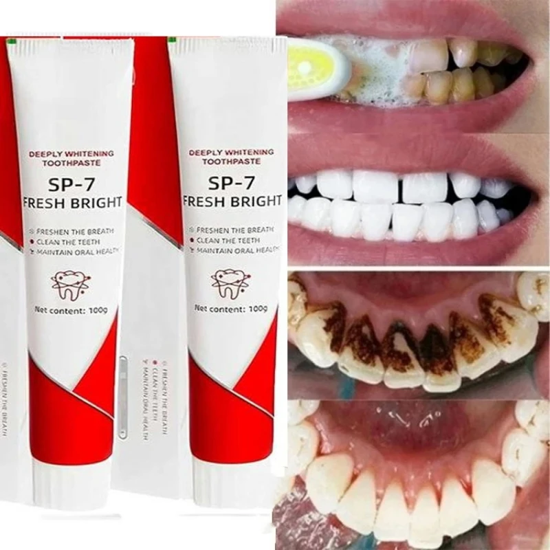 SP-7 Toothpaste Oral Health Management Deep Probiotic Whitening Toothpaste Fresh